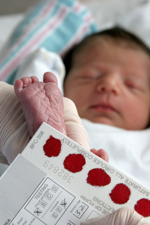 newborn bloodspot screening test Over the past few months, we’ve consulted widely with clinical, laboratory and quality assurance colleagues to help revise the newborn blood spot screening. newborn bloodspot screening test Over the past few months, we’ve consulted widely with clinical, laboratory and quality assurance colleagues to help revise the newborn blood spot screening.